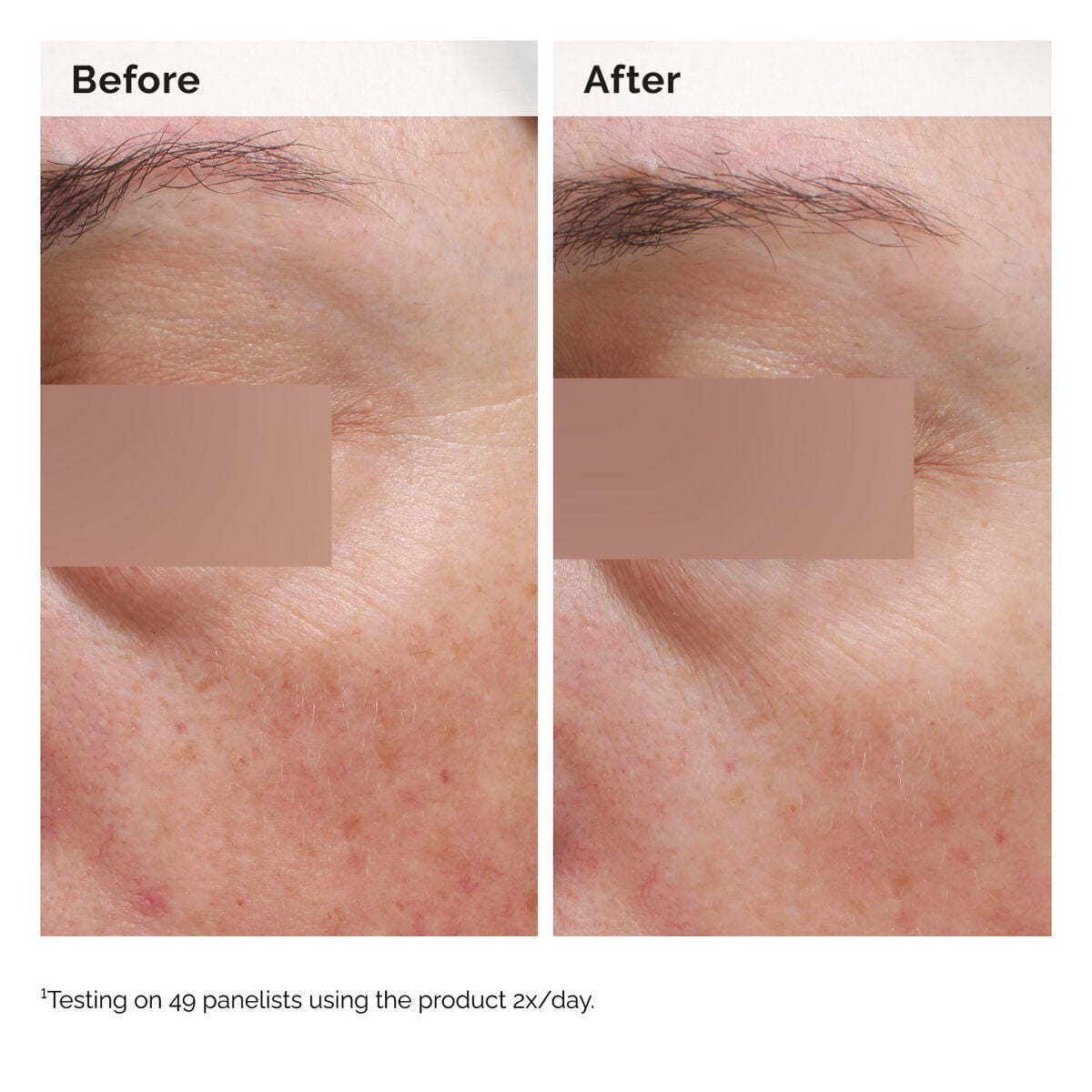 niacinamide-5-face-and-body-emulsion-v3 2024-08-23-ORD-Nia-5pct-Face-Body-B-A-Elasticity-Global-02-1x1.jpg
