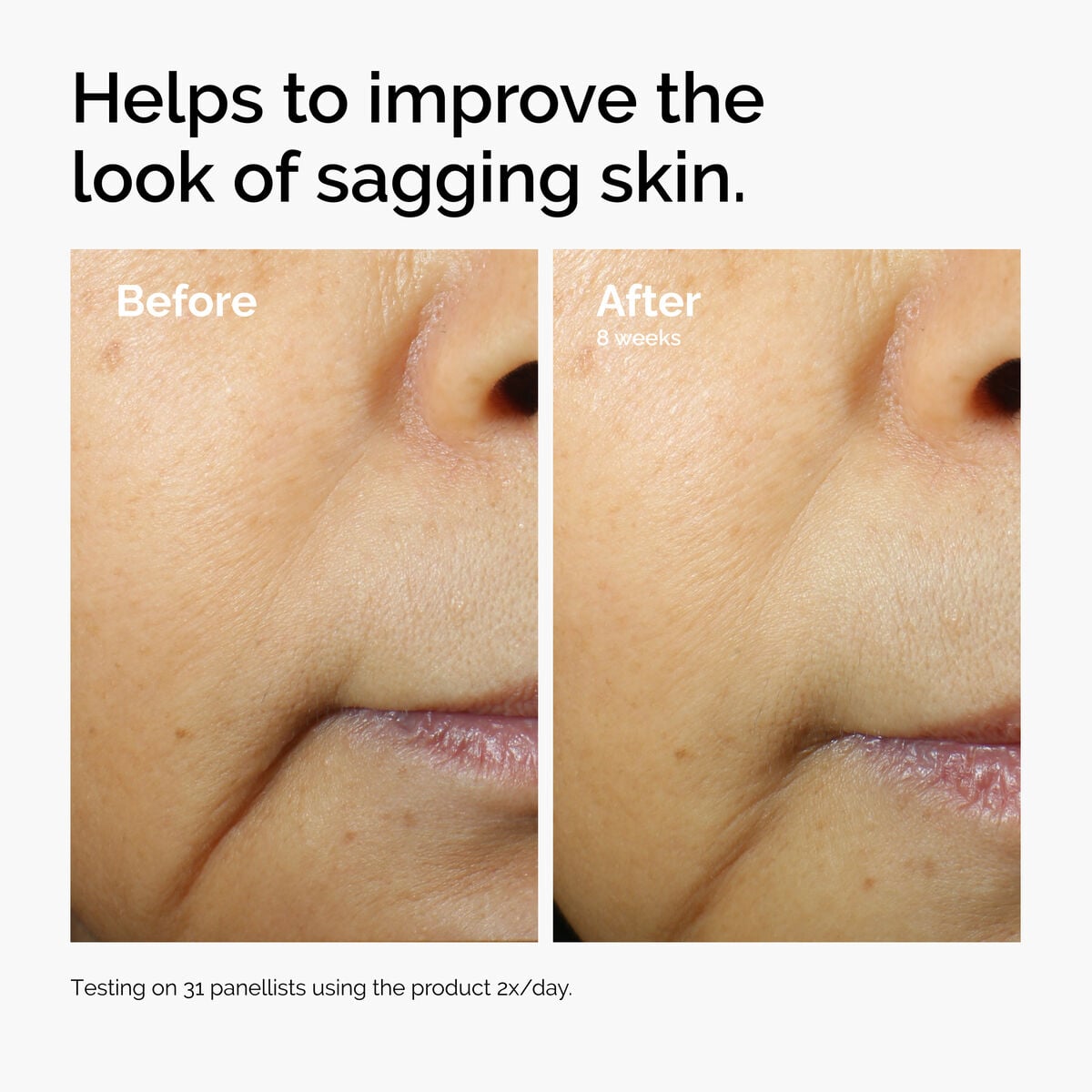 caffeine-3-escin-1-face-serum-y5 ord-caffeine-3pct-escin-1pct-face-serum-before-after-sagging.jpg