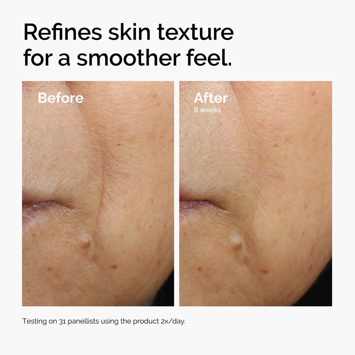 caffeine-3-escin-1-face-serum-y5 ord-caffeine-3pct-escin-1pct-face-serum-before-after-texture.jpg