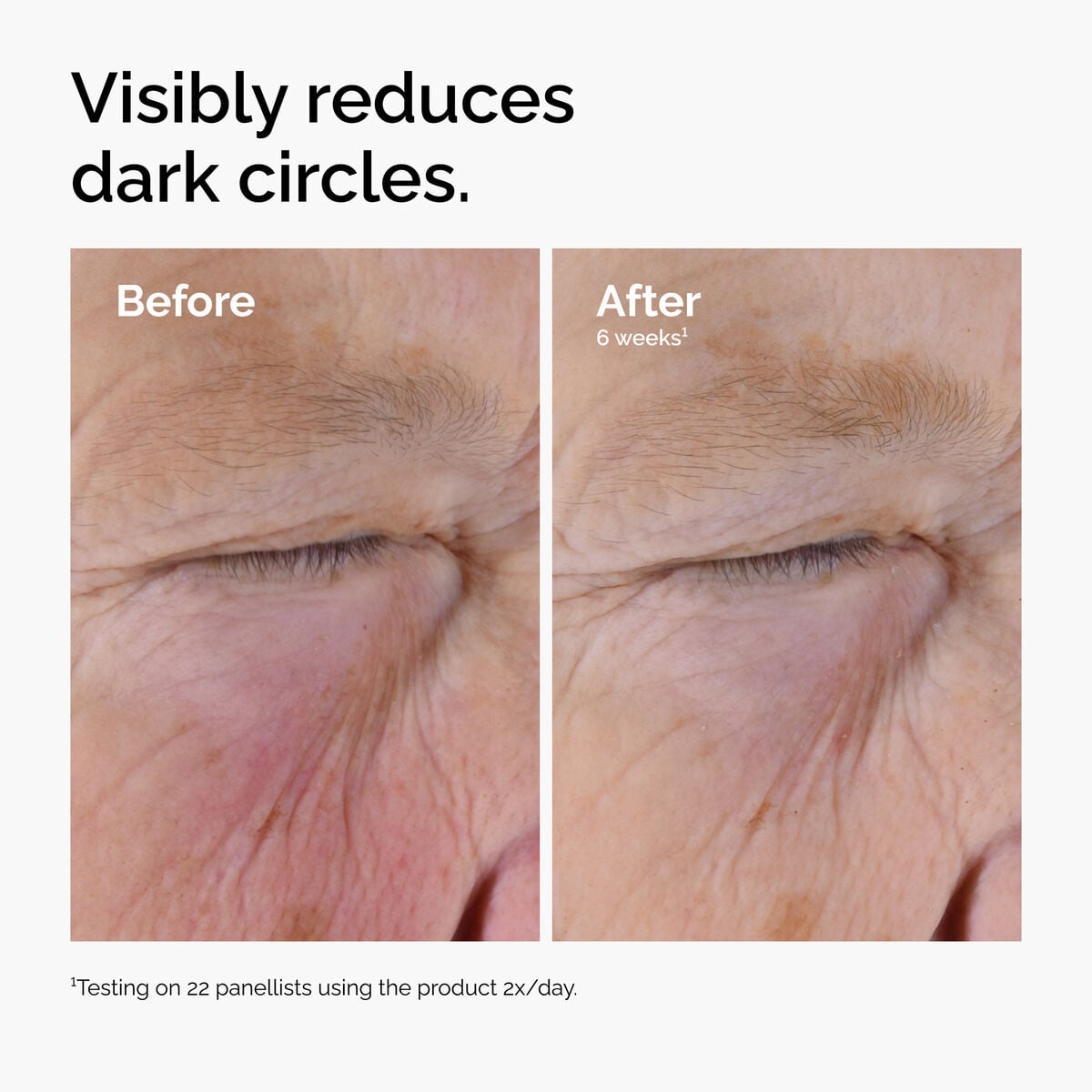 caffeine-solution-5-egcg-eye-serum-p5 ord-caffeine-solution-egcg-dark-circles-before-after.jpg