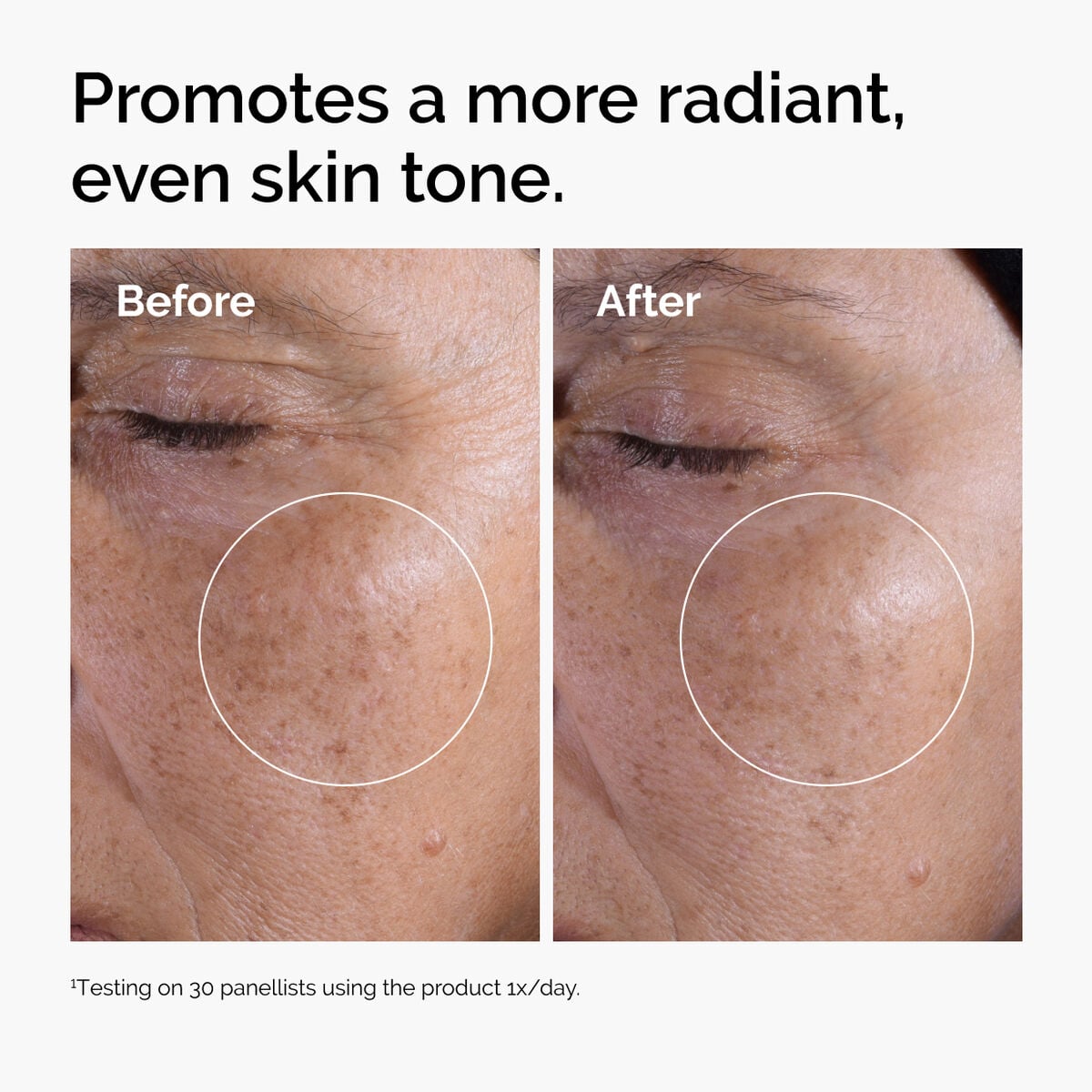 glycolic-acid-7-exfoliating-toner-h2 ord-glycolic-before-after-radiance.jpg