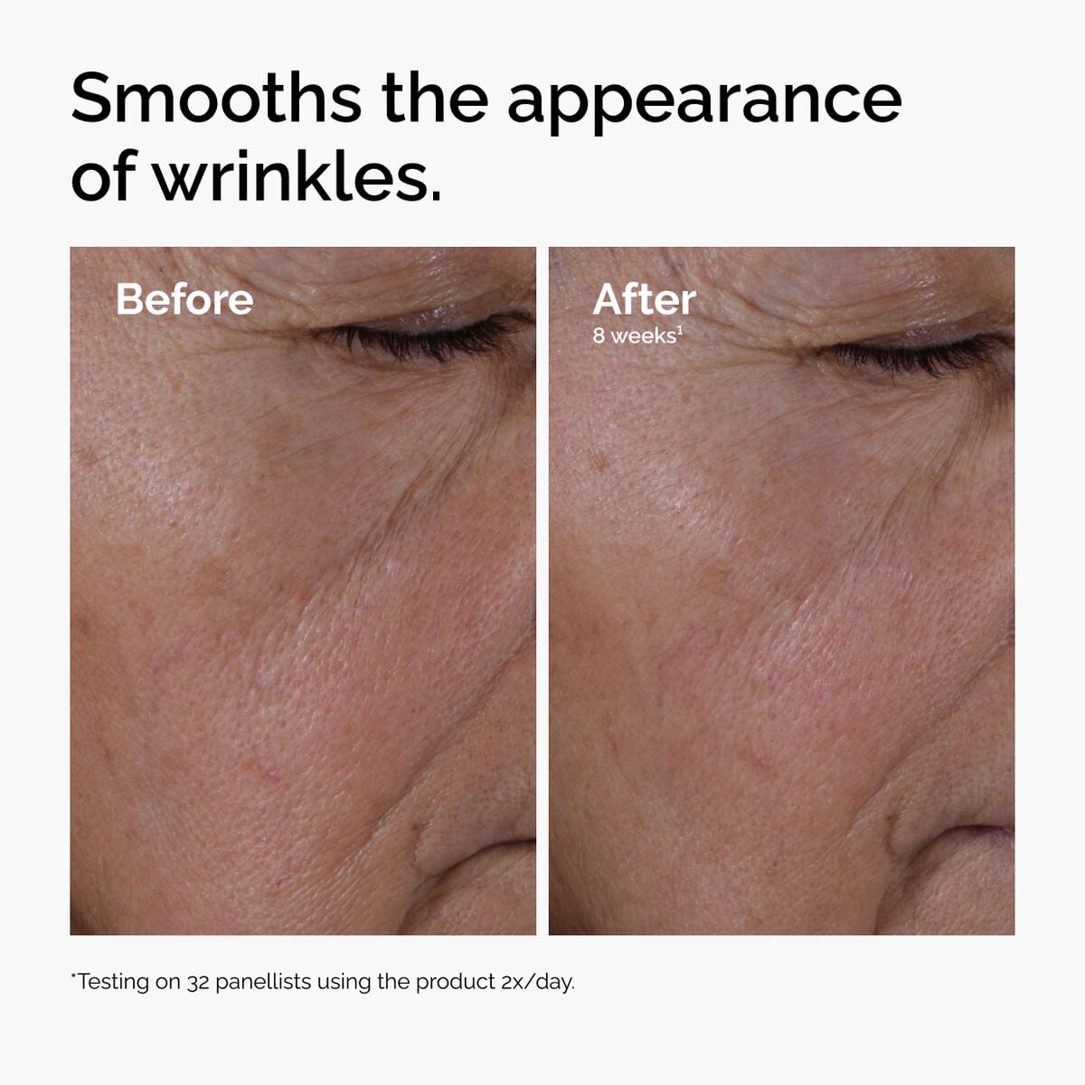 multi-peptide-ha-serum-j0 ord-multi-peptide-ha-serum-wrinkles-before-after.jpg