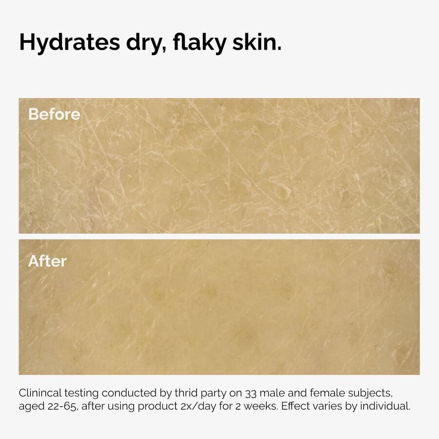the-body-care-collection-m2 ord-natural-moisturizing-factors-inulin-body-before-after-graphic-02.jpg