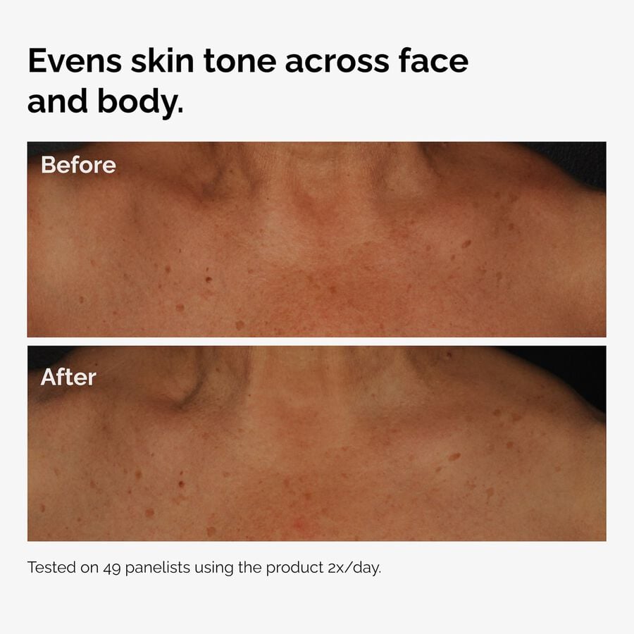 the-body-care-collection-m2 ord-niacinamide-face-body-serum-before-after-even-tone-graphic.jpg