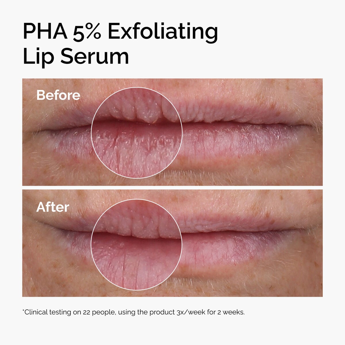 pha-5-exfoliating-lip-serum-f8 ord-pha-5pct-lip-exfoliating-serum-before-after.jpg